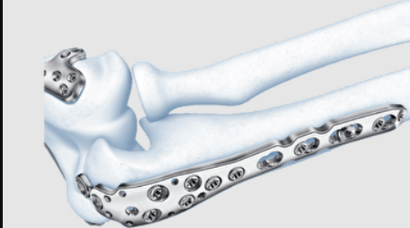 3.5MM LCP Pelvic Recon Plate